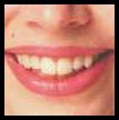 Dental Insurance Connecticut Dental Insurance Connecticut